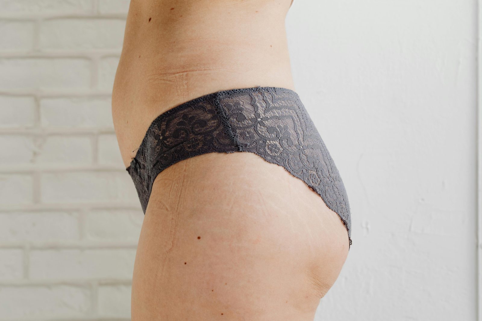 Augmentation du volume fessier par biostimulateurs, Québec | Buttock volume enhancement with biostimulators, Quebec Silhouettes mettant en valeur le galbe des fesses avant traitement d'augmentation du volume fessier à la clinique Le Centre au Québec | Silhouettes highlighting buttock contour before non-surgical buttock volume enhancement treatment at Le Centre clinic in Quebec
